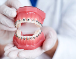 the cost of traditional braces in coatesville