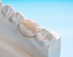 Close up of dental crown in Thorndale, PA in model of teeth