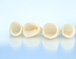 Four dental crowns sitting in a row