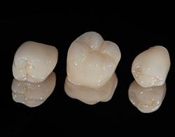 Three dental crowns on a black surface