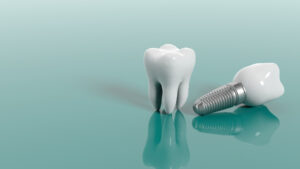 Dental implant and molar on green background